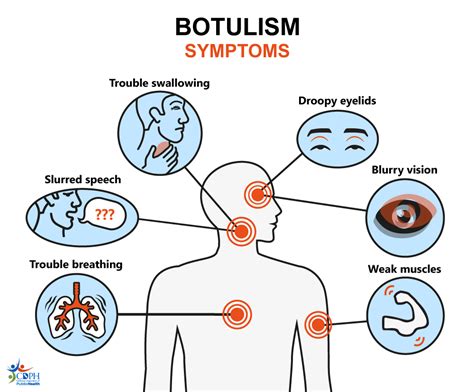 Botulism poisoning
