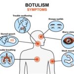 Botulism poisoning